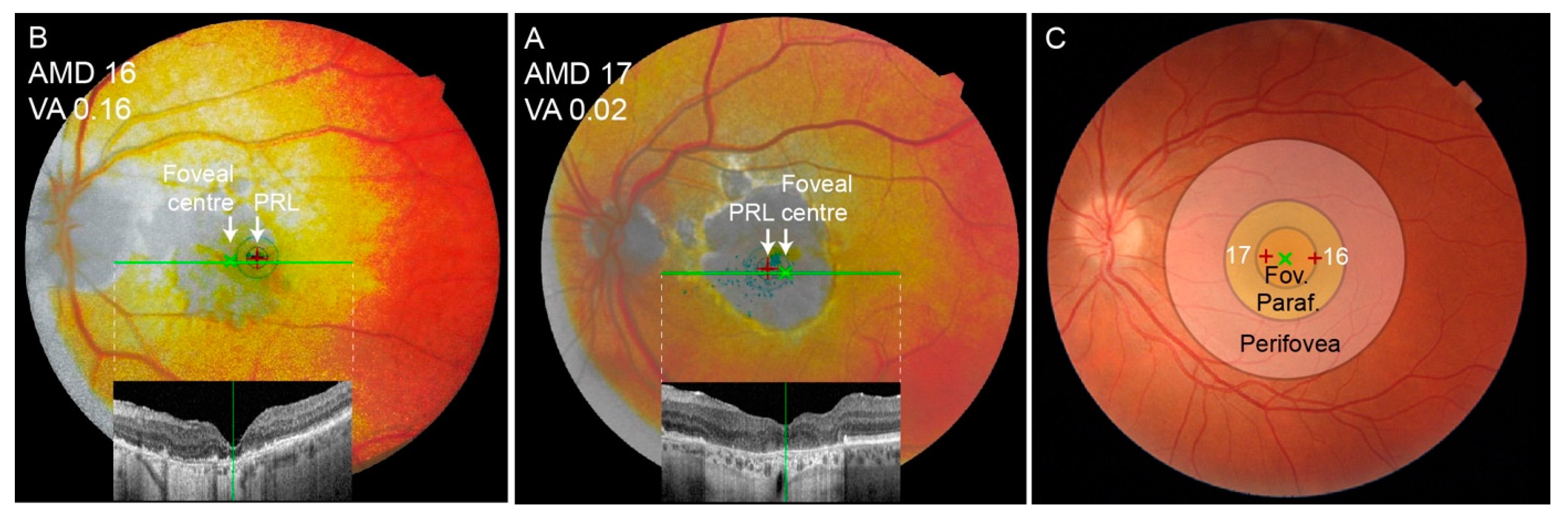 Jcm 13 00636 g007 Jcm 13 00636 g007