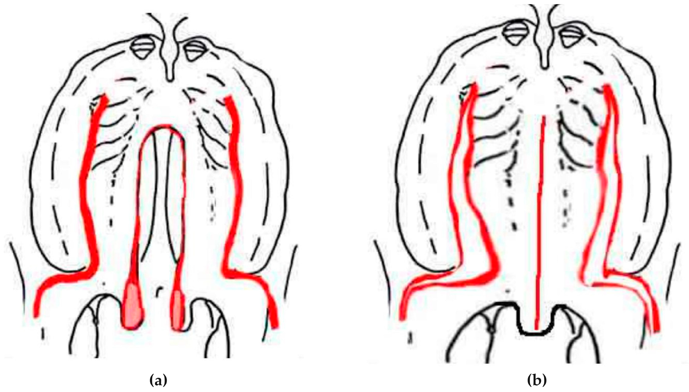 Jcm 13 01939 g004 Jcm 13 01939 g004