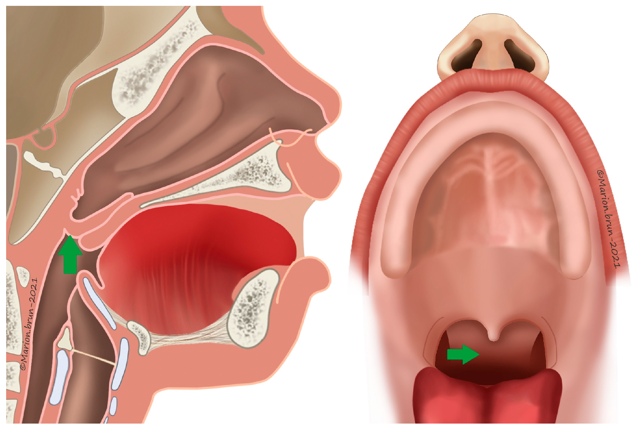 Jcm 13 01939 g007 Jcm 13 01939 g007