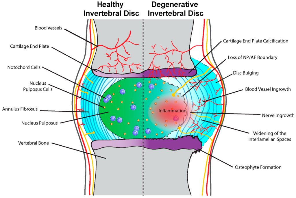 JDB | Free Full-Text | Notochord Cells in Intervertebral Disc