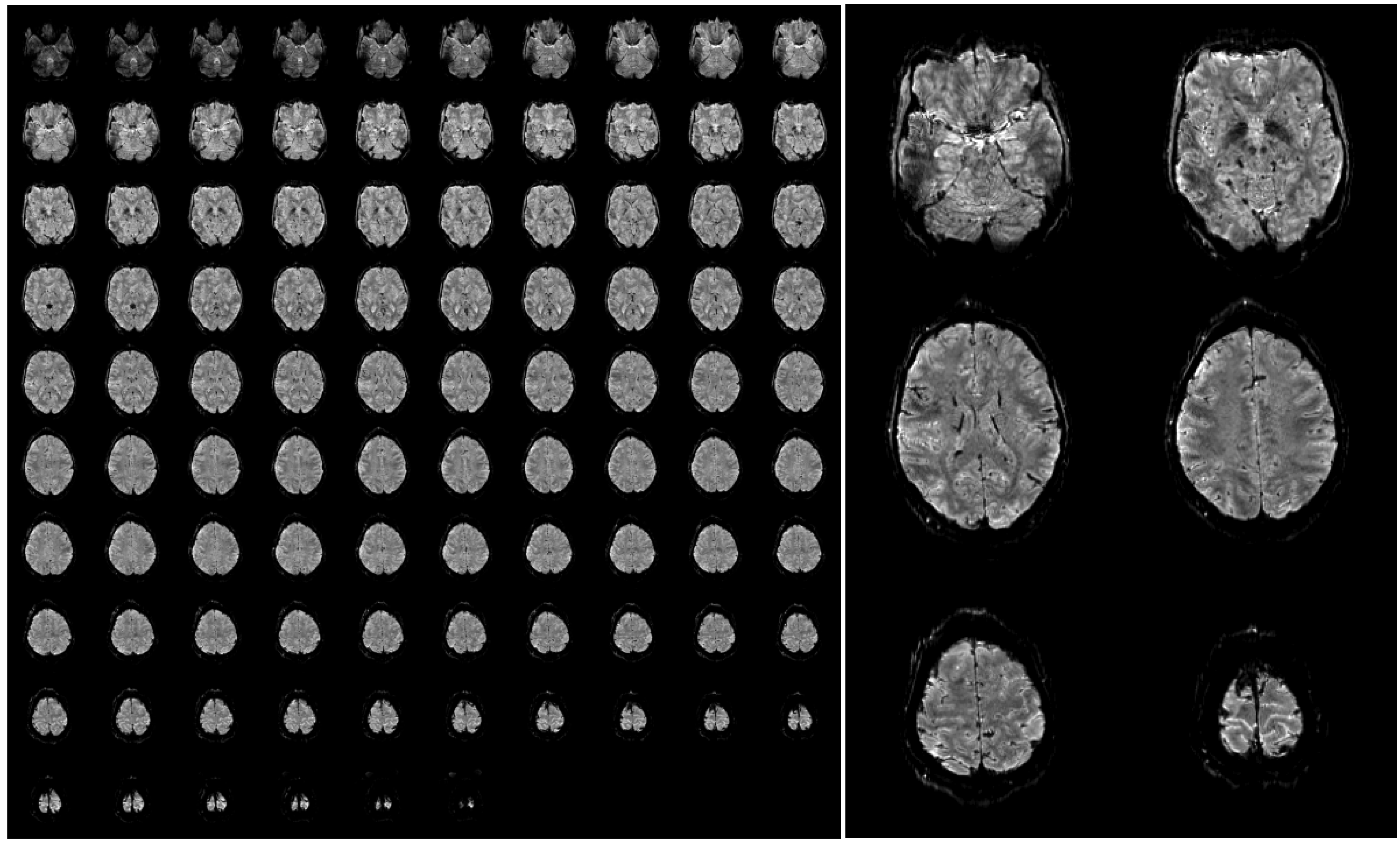 Materials 04 01941 g004