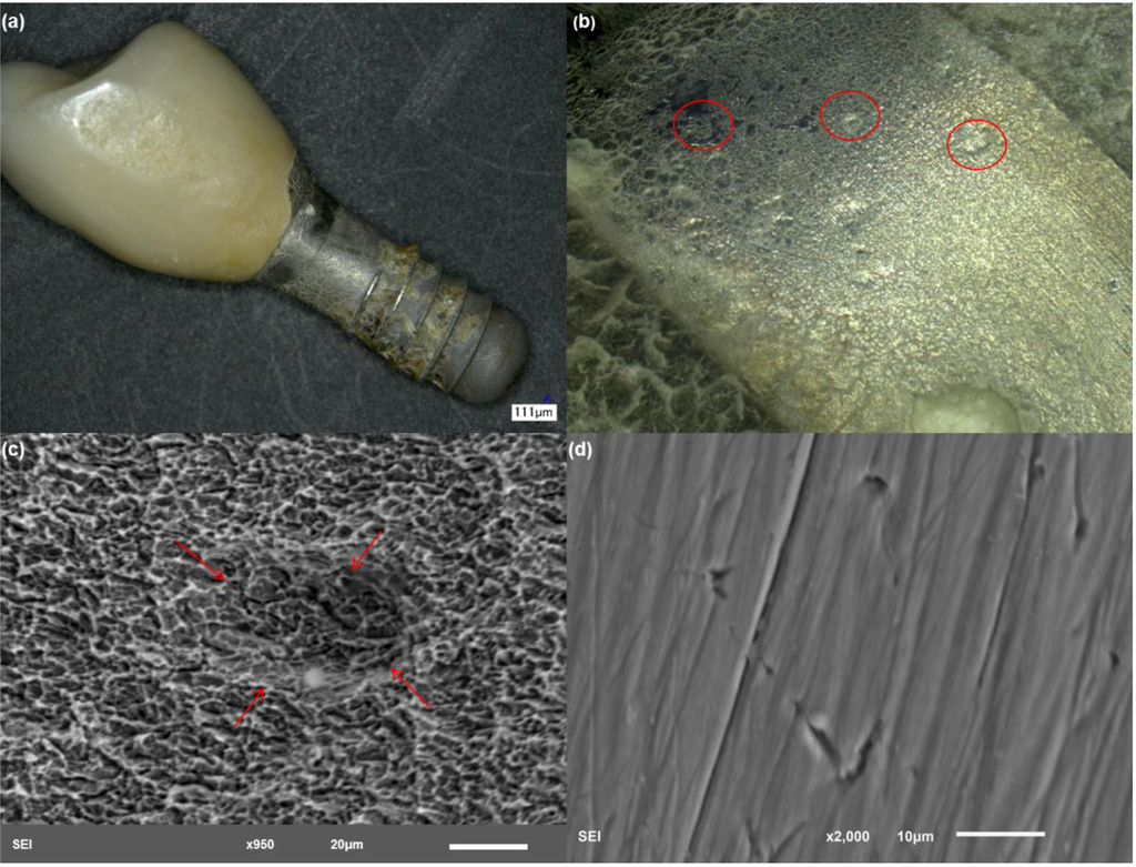 Materials Free FullText Titanium Corrosion Mechanisms in the Oral