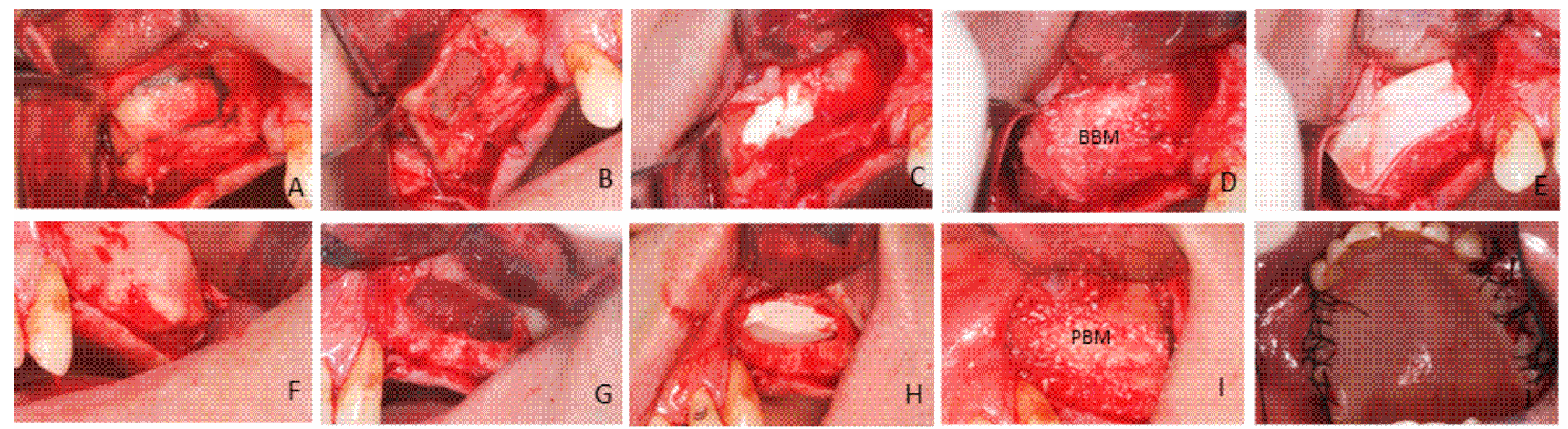 Materials 10 00623 g009