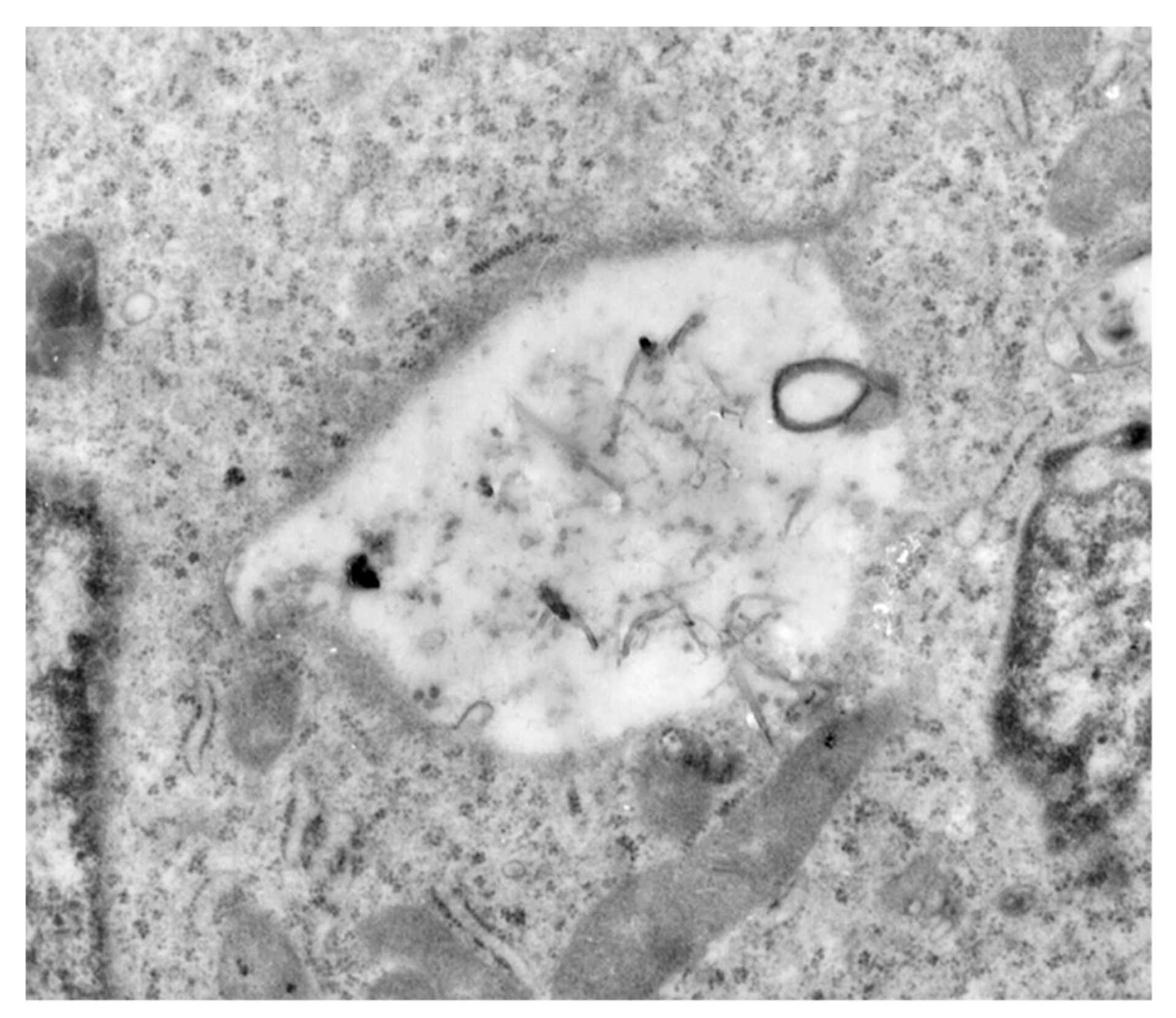 Materials 12 02889 g008