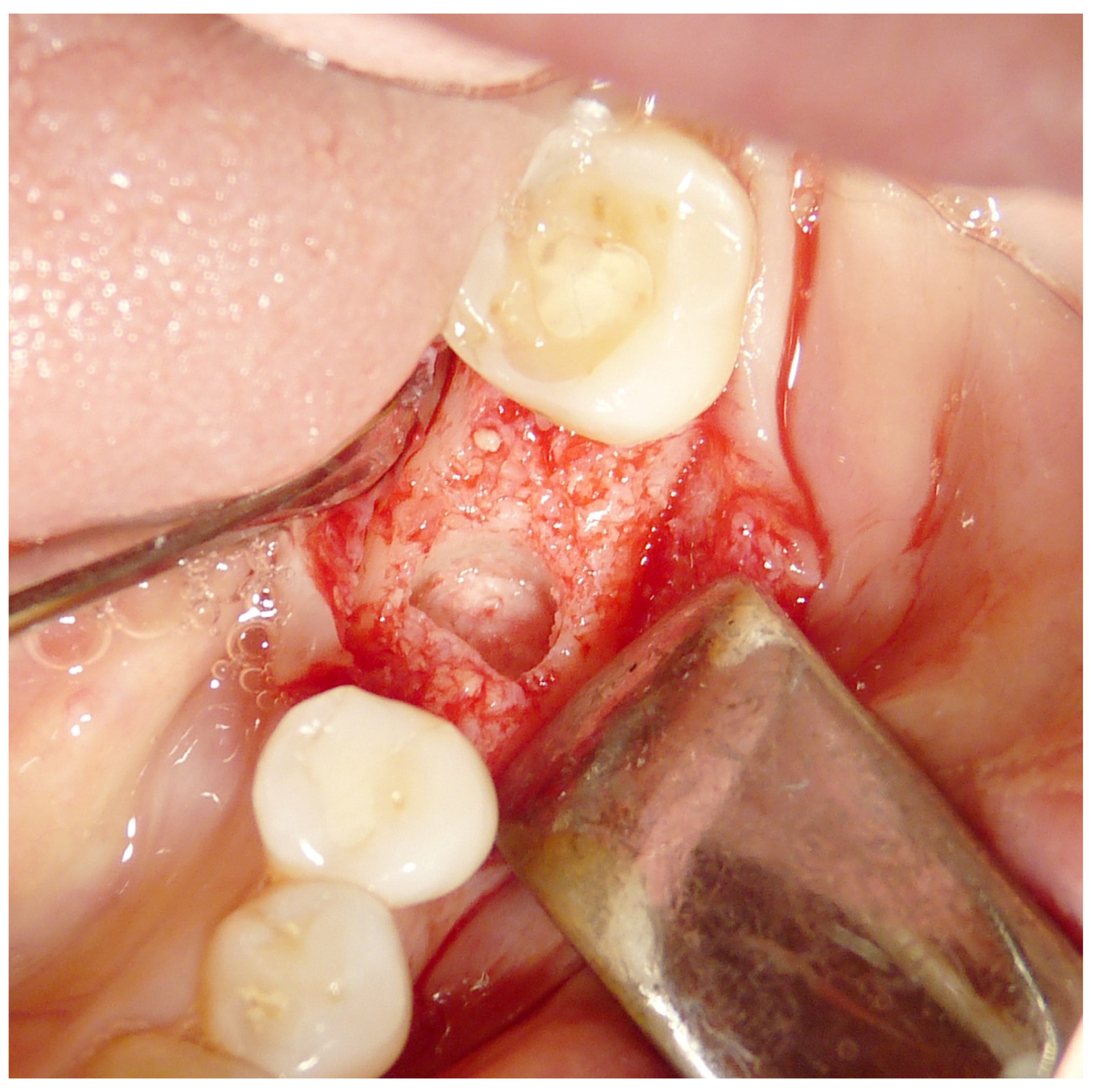 Materials 16 04945 g002