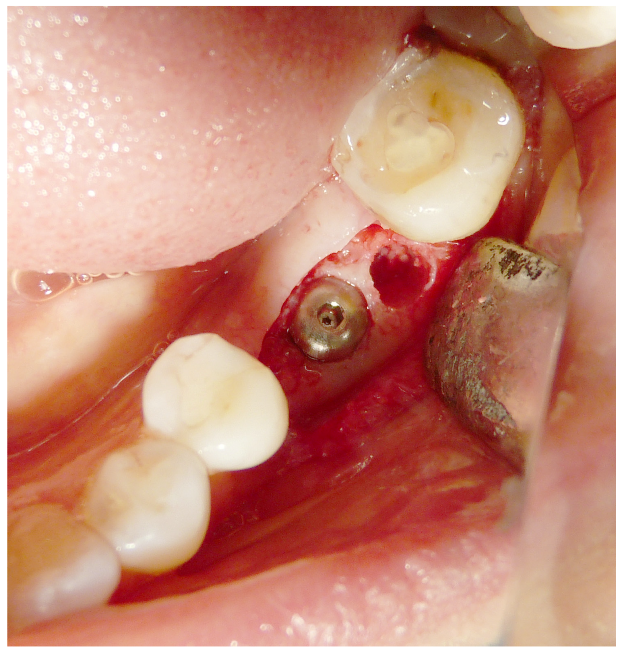 Materials 16 04945 g004