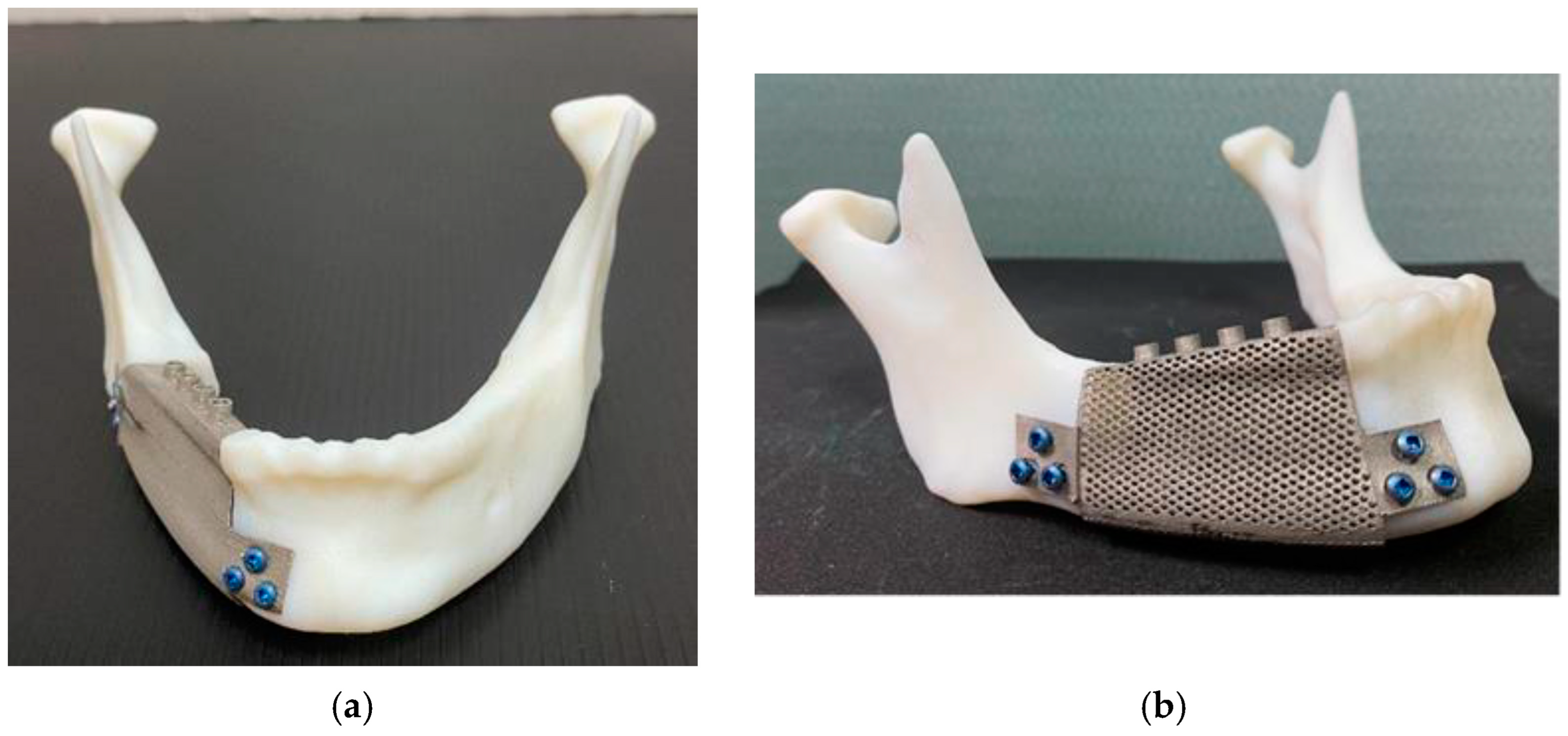 Materials 17 00140 g005