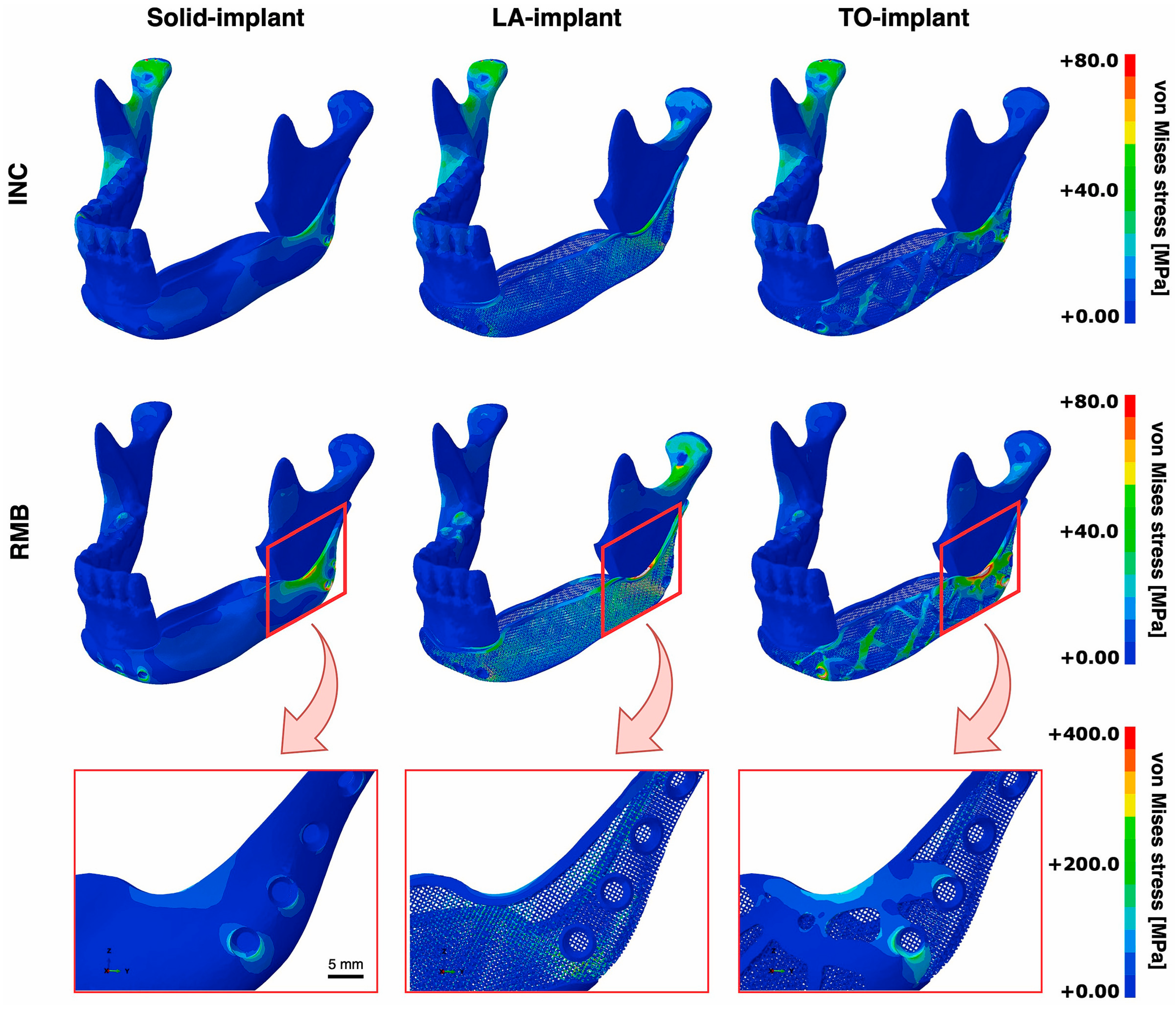 Materials 17 00140 g006