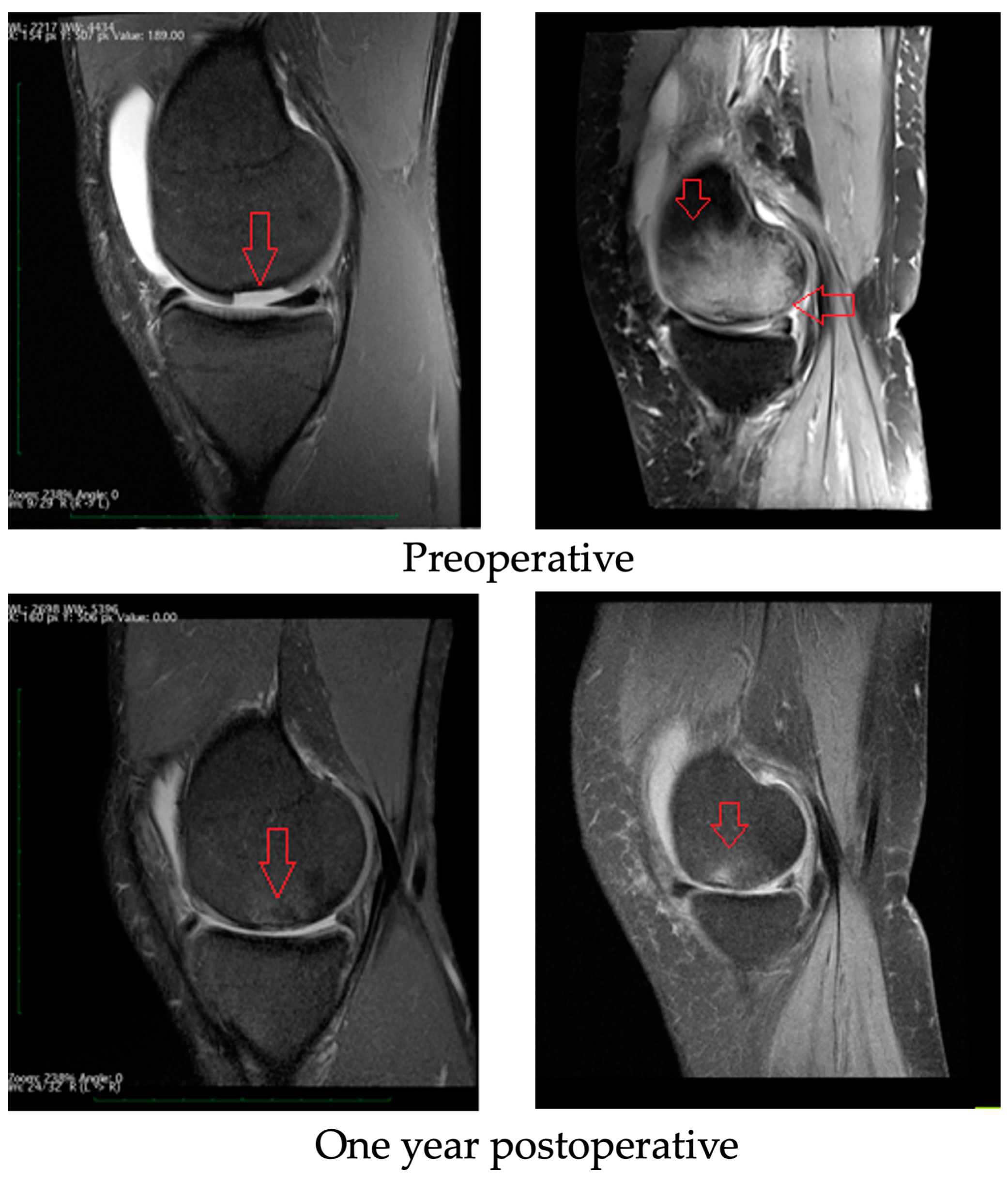 Medicina 59 00804 g006