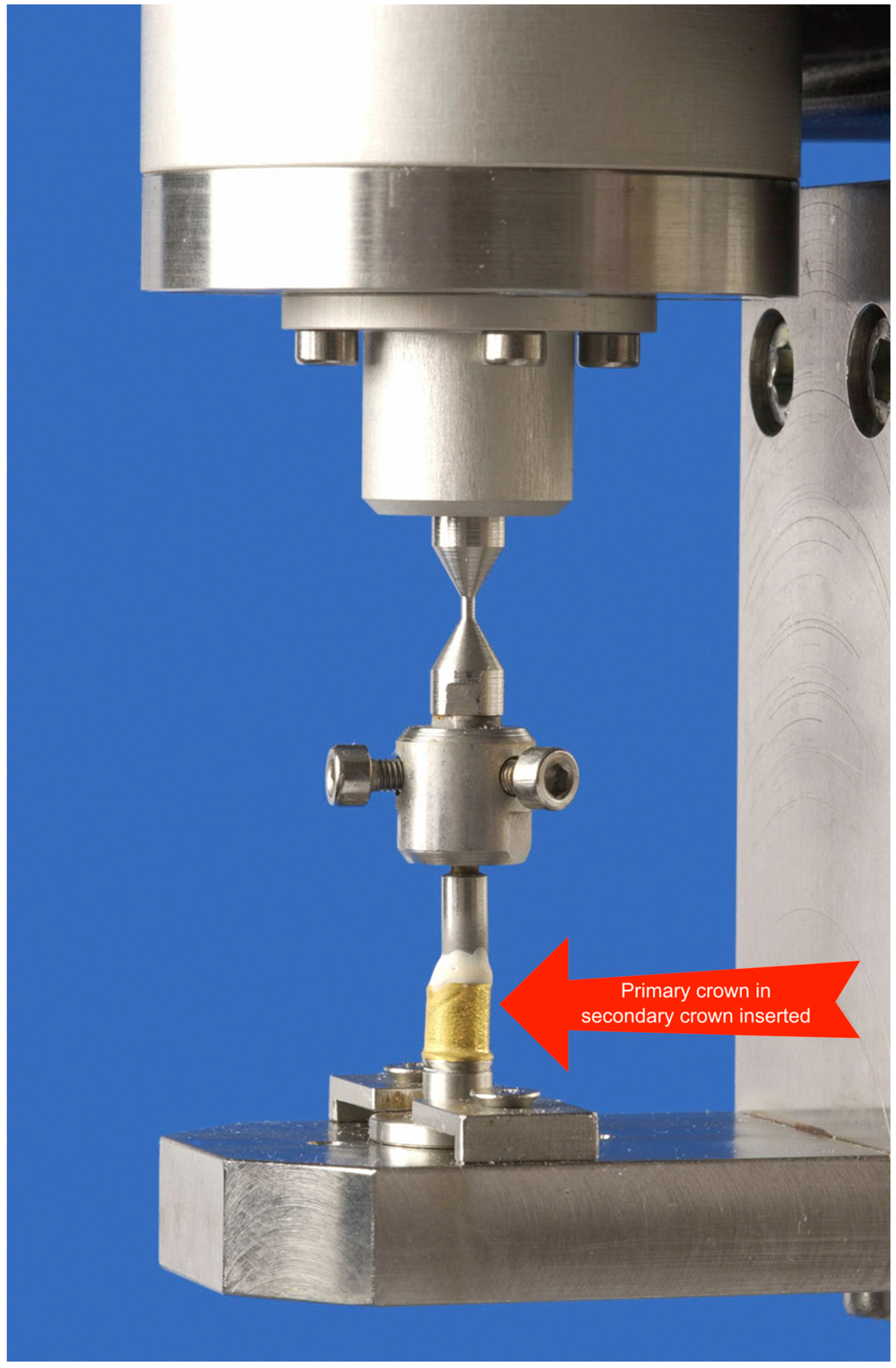 Metals 06 00149 g004