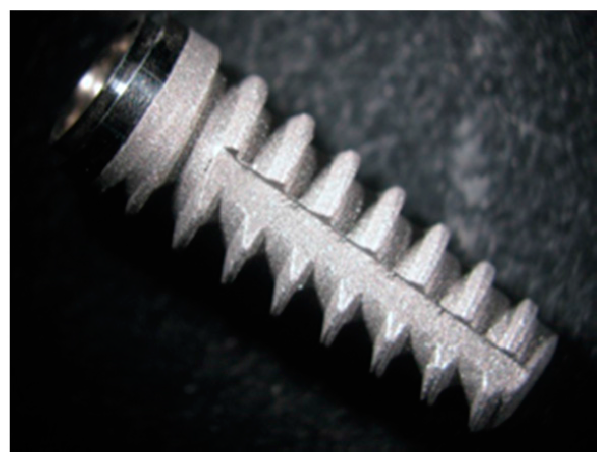 Metals 07 00167 g001
