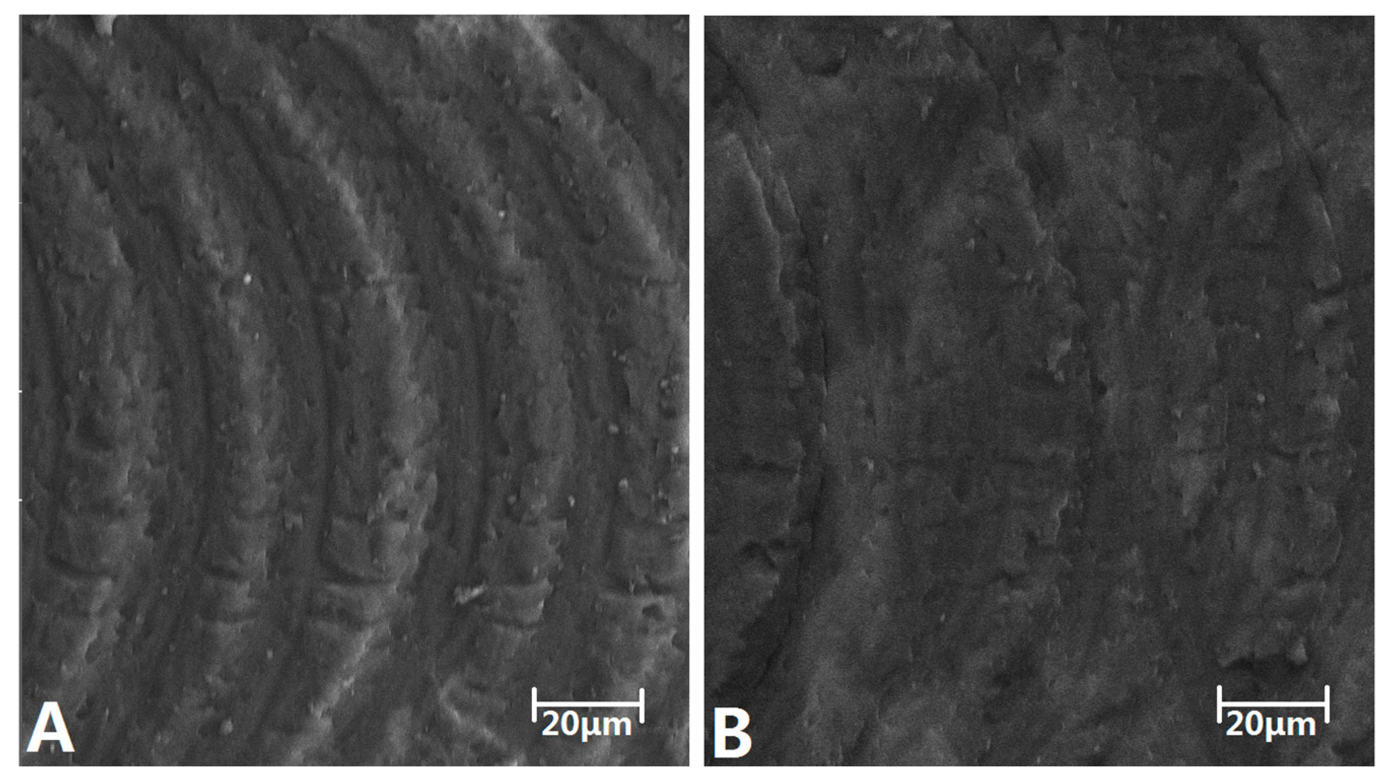 Micromachines 05 01416 g007