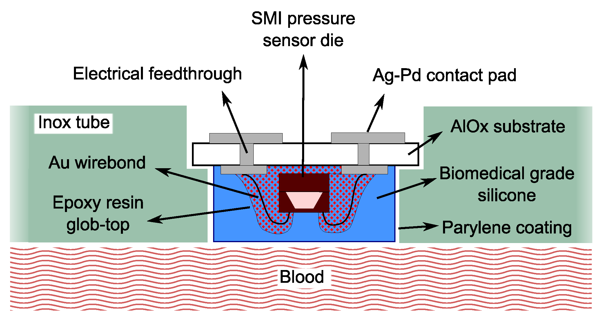 An Implantable Intravascular Pressure Circuit Diagram