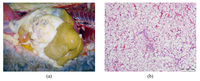 Nutrients 05 02811 g004 200