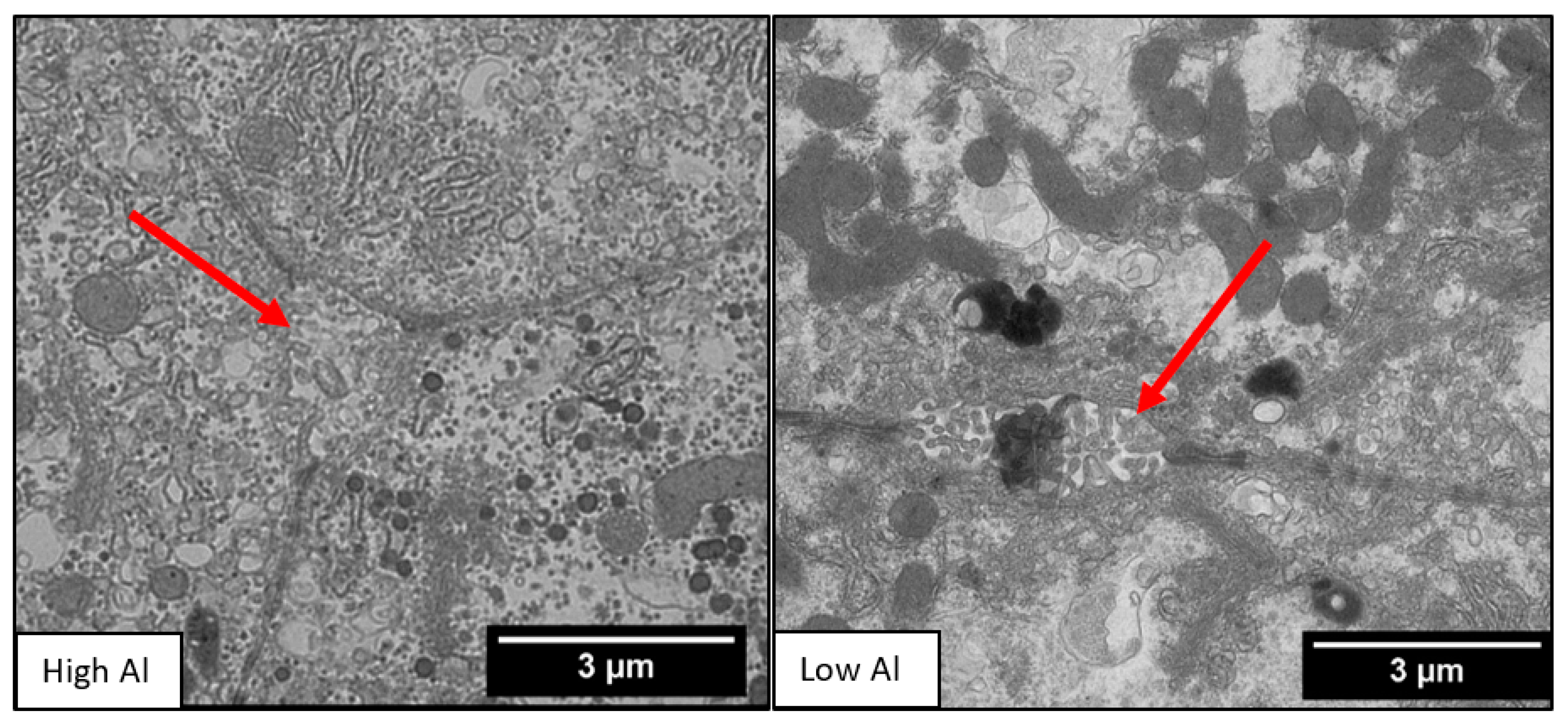 Nutrients 10 00723 g003