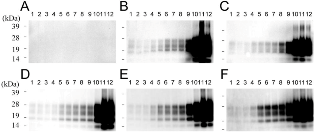 Pathogens 02 00092 g005 1024