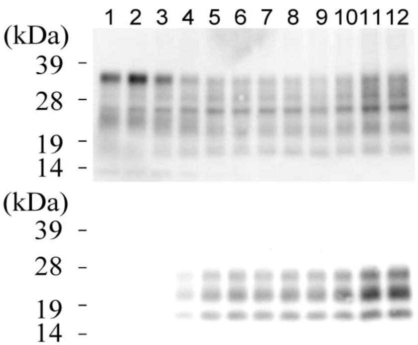Pathogens 02 00092 g006 1024