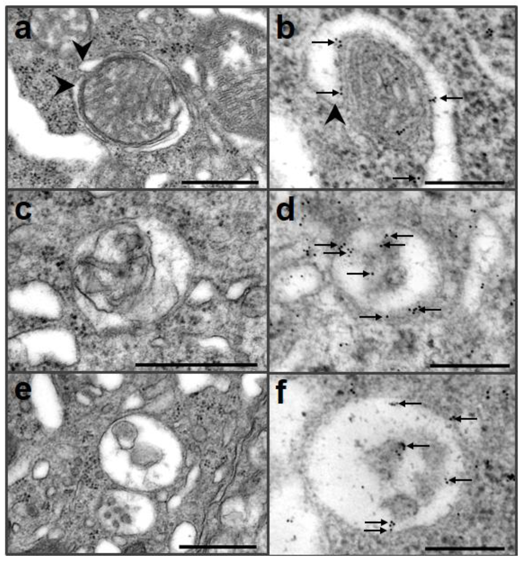 Pathogens 02 00436 g002 1024