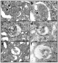 Pathogens 02 00436 g002 200