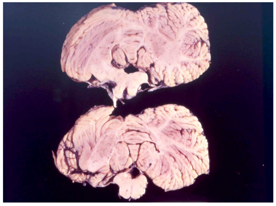 Pathogens 02 00472 g012 1024