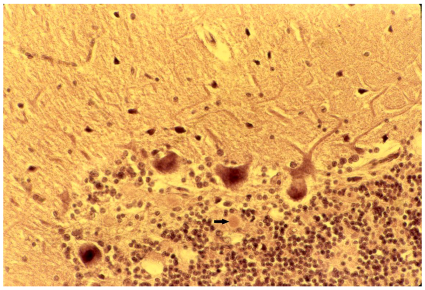 Pathogens 02 00472 g013 1024