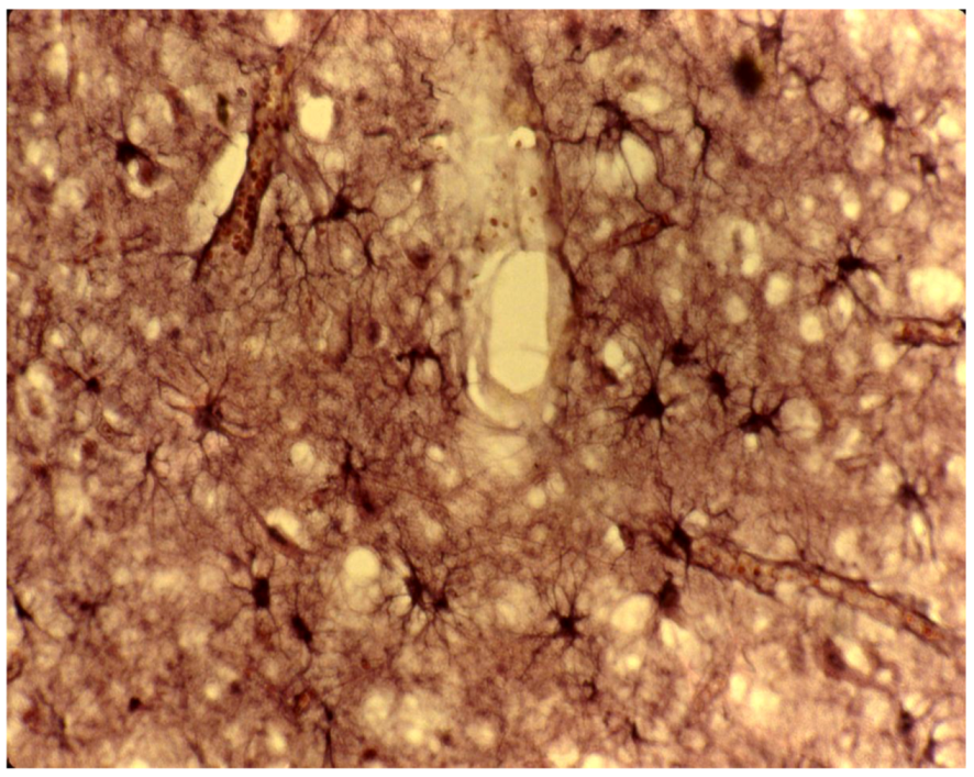 Pathogens 02 00472 g014 1024