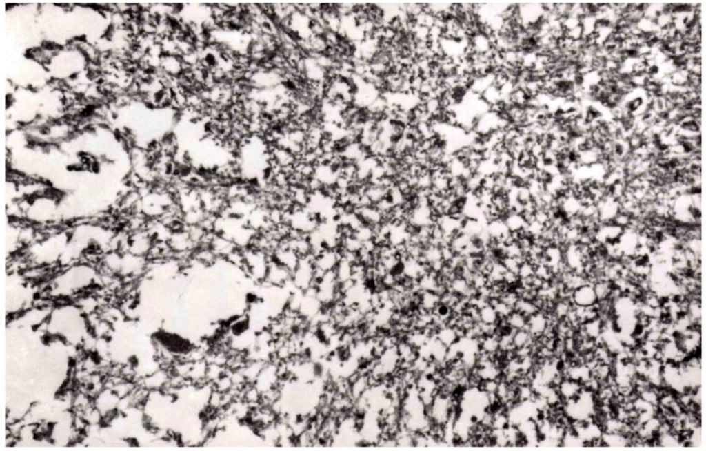 Pathogens 02 00472 g016 1024