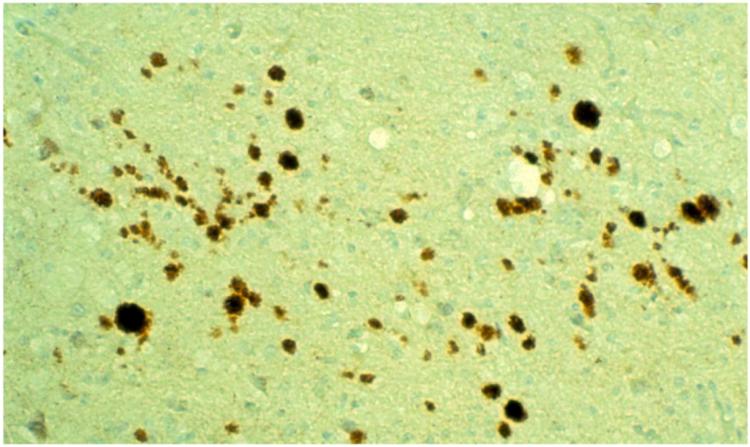 Pathogens 02 00472 g017 1024