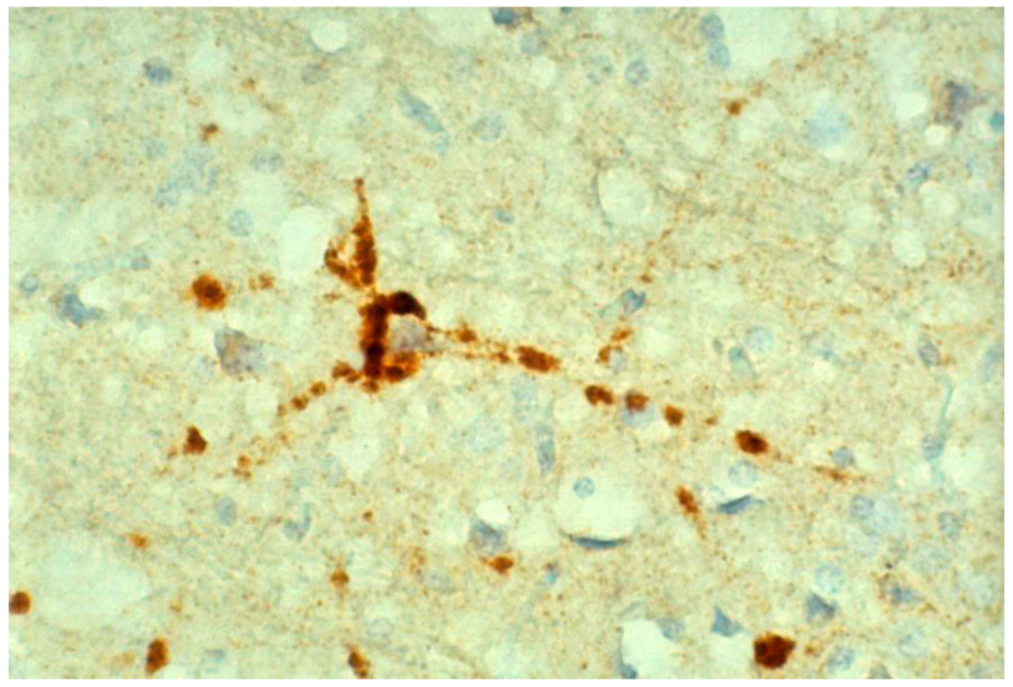 Pathogens 02 00472 g020 1024