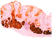 Pathogens 03 00073 g010 200