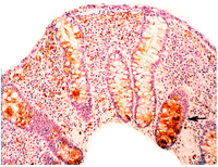 Pathogens 03 00073 g013 200