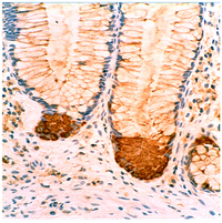 Pathogens 03 00073 g015 200