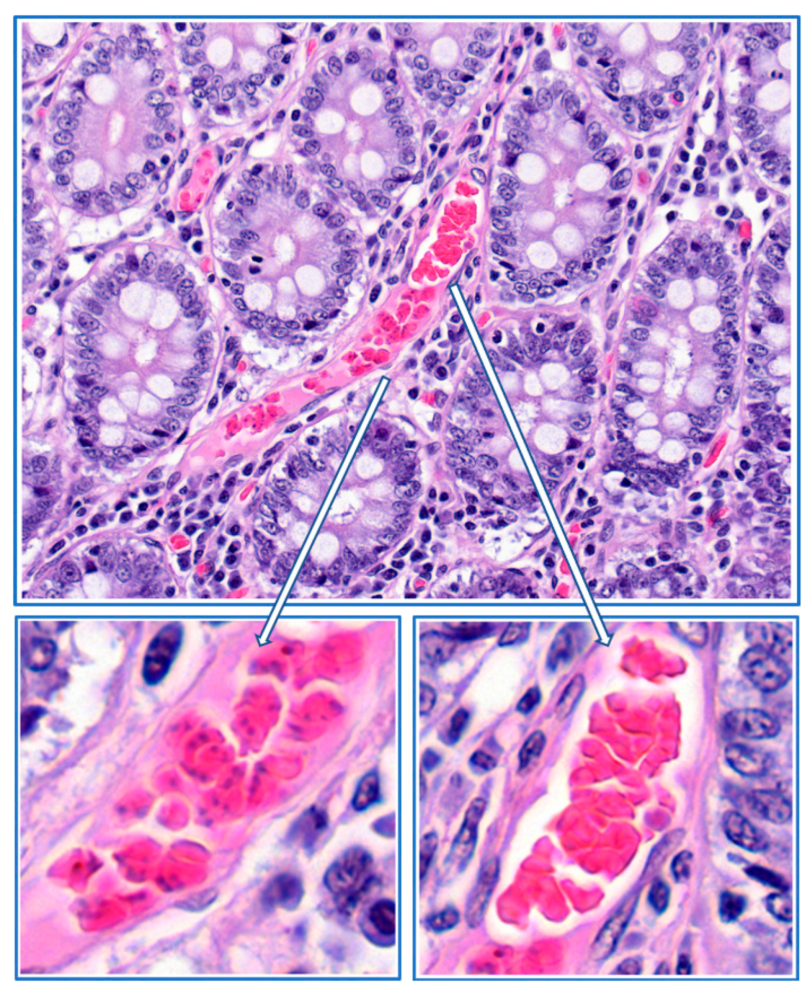 Pathogens 08 00094 g011 Pathogens 08 00094 g011