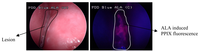 Pharmaceutics 03 00354f2 200