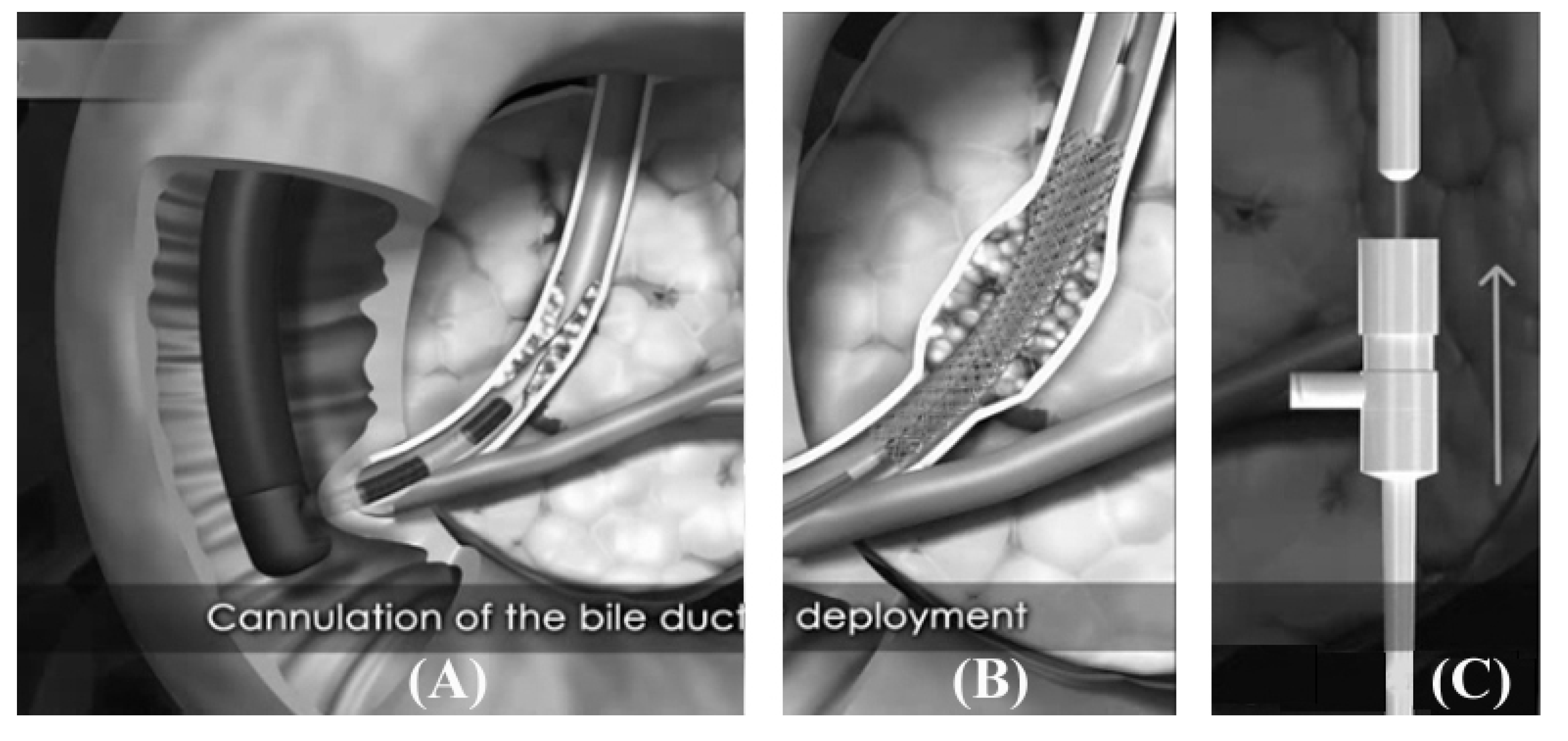 Polymers 06 00755 g003