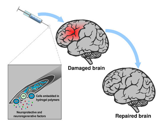 Polymers Free Full Text Hydrogels Isted Cell Engraftment Polymers Free Full Text Hydrogels Isted Cell Engraftment For Repairing The Stroke Damaged Brain Chimera Or Reality Html