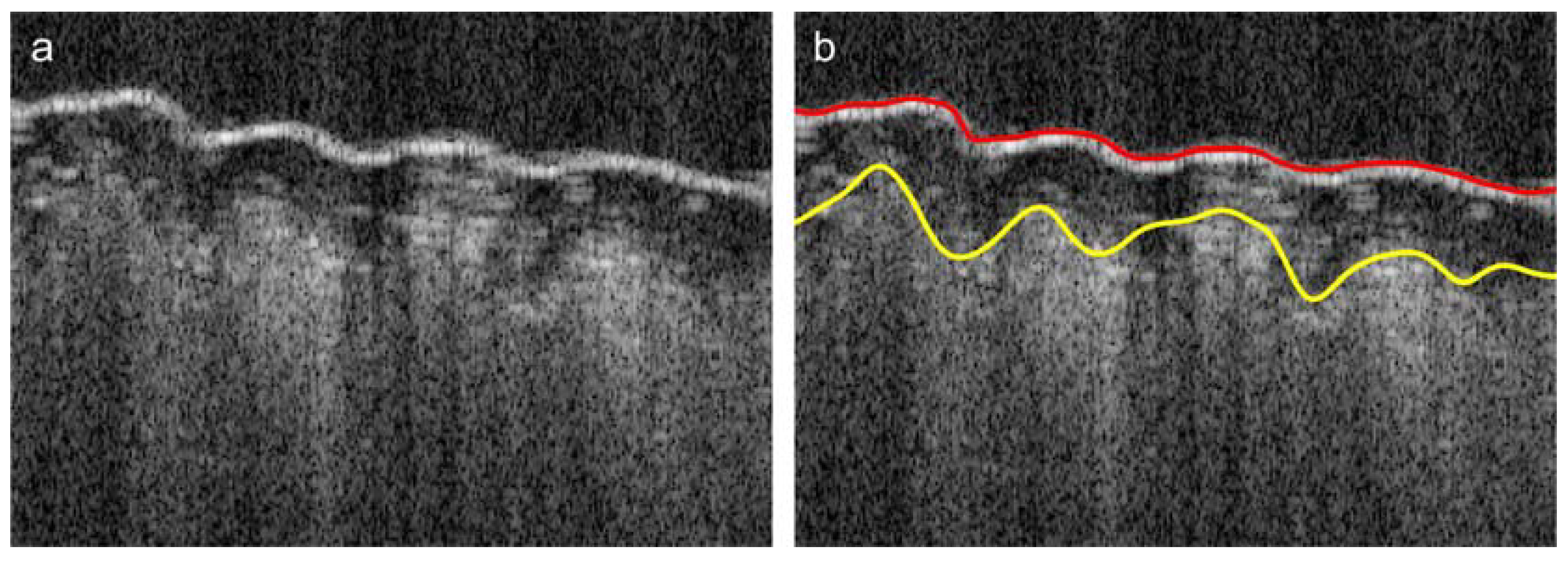 Polymers 10 00469 g012