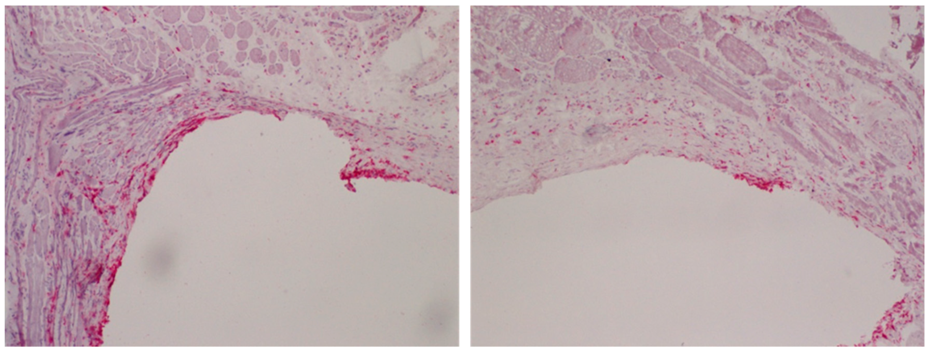Polymers 11 01004 g003