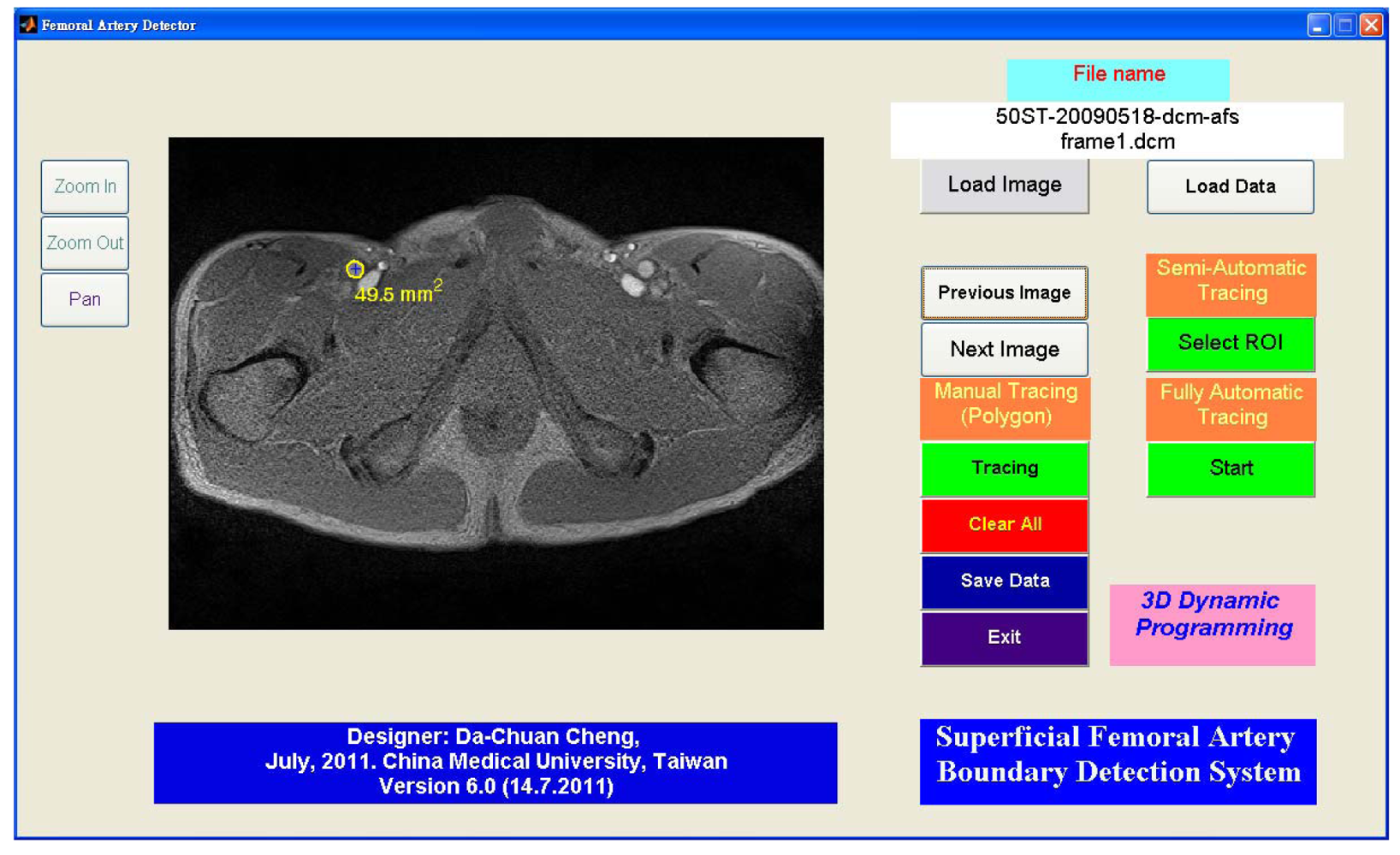 Sensors 12 05195f12 1024