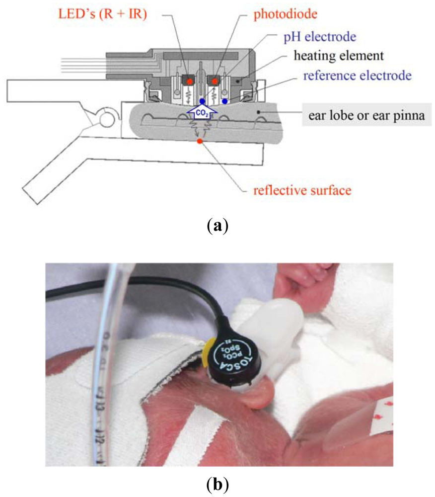 Sensors 12 10980f1 1024