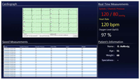 Sensors 12 11435f5 200