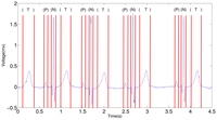 Sensors 12 12844f15 200