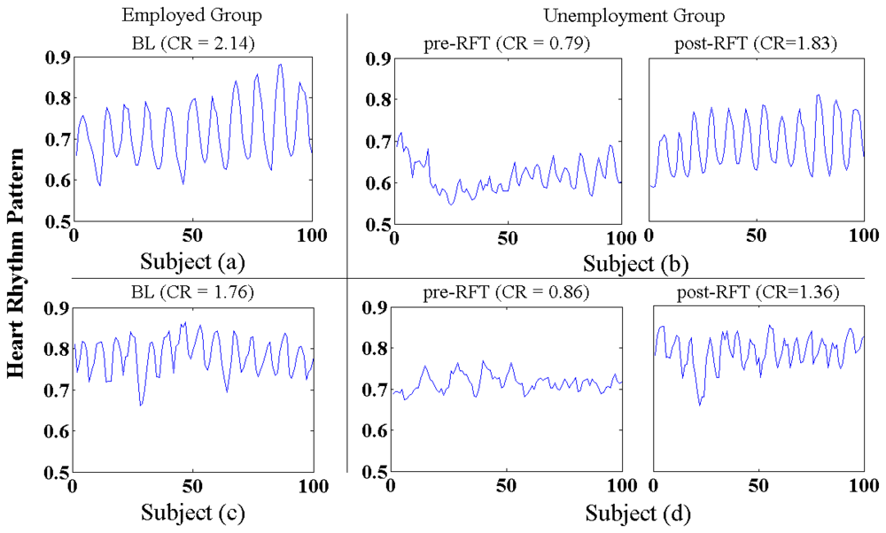 Sensors 12 13225f12 1024