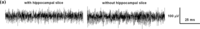 Sensors 12 16571f10a 200