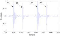 Sensors 13 02530f2 200