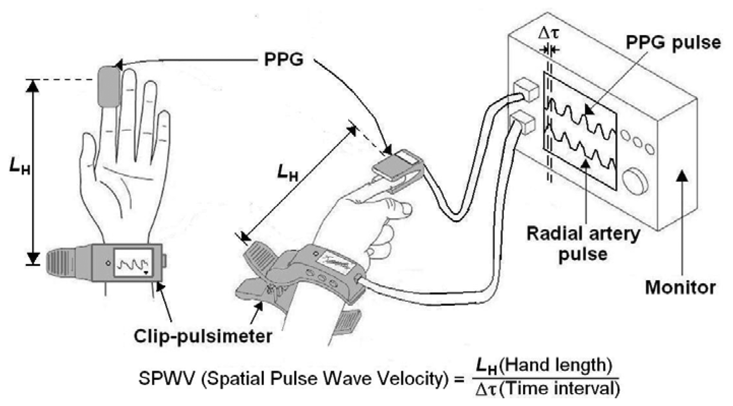 Sensors Free FullText Measurement of Spatial Pulse Wave Velocity