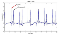 Sensors 13 06141f21 200