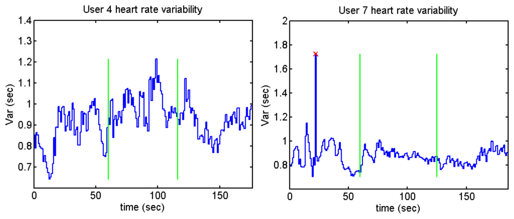 heart rate variability thesis Hrv4training helps you optimize your goals and prevent overtraining by measuring your heart rate and heart rate variability no sensors needed. heart rate variability thesis Hrv4training helps you optimize your goals and prevent overtraining by measuring your heart rate and heart rate variability no sensors needed.
