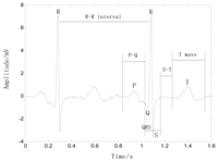 Sensors 13 06832f1 200