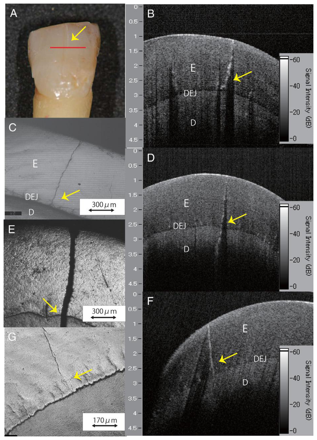 Sensors Free FullText Dental Optical Coherence Tomography